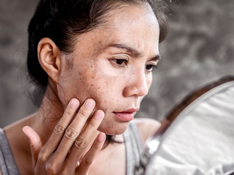 cách làm trắng da toàn thân