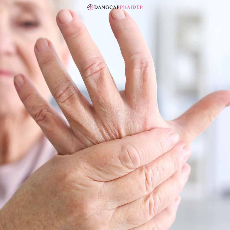 Người bị lupus, viêm khớp dạng thấp không nên dùng đông trùng hạ thảo.