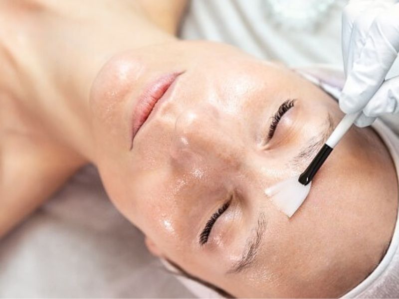 Bao lâu thì peel da 1 lần? Tần suất phù hợp cho từng loại da