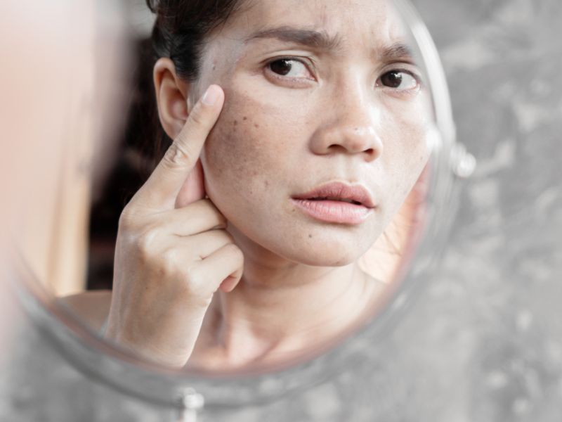 Các vấn đề về da thường gặp ở bà bầu và cách khắc phục