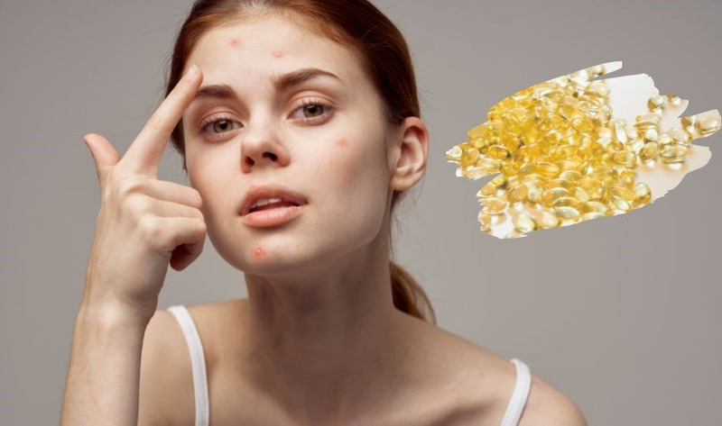 Một số lưu ý về cách làm trắng da bằng Vitamin E tại nhà