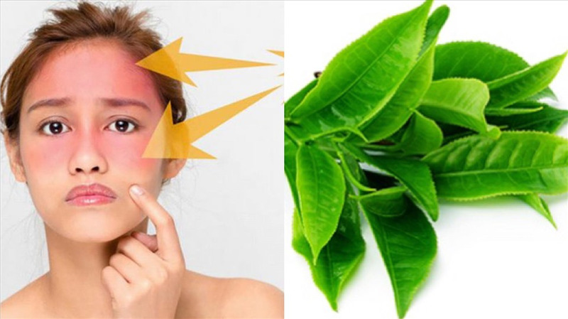 Sử dụng nguyên liệu thiên nhiên để dưỡng da cháy nắng