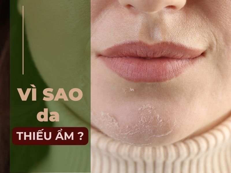 Da thiếu ẩm