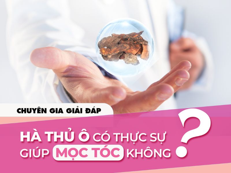 Chuyên gia giải đáp: Hà thủ ô có thực sự giúp mọc tóc không?