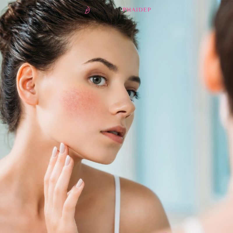 Da nhạy cảm cần xem xét kỹ thành phần có trong sản phẩm.