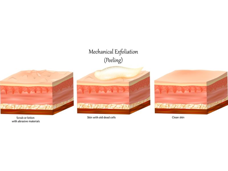 Peel da sử dụng các hợp chất hóa học lên bề mặt da nhằm tăng cường tái tạo tế bào mới