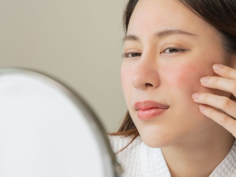 Sờ tay lên mặt là thói quen xấu ảnh hưởng đến làn da cần loại bỏ 