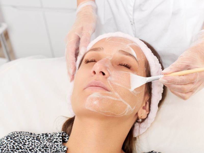 Quy trình peel không đúng chuẩn gây đỏ da sau peel