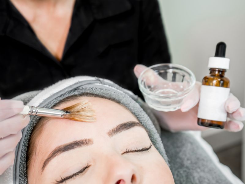 Sử dụng dung dịch peel kém chất lượng gây đỏ da