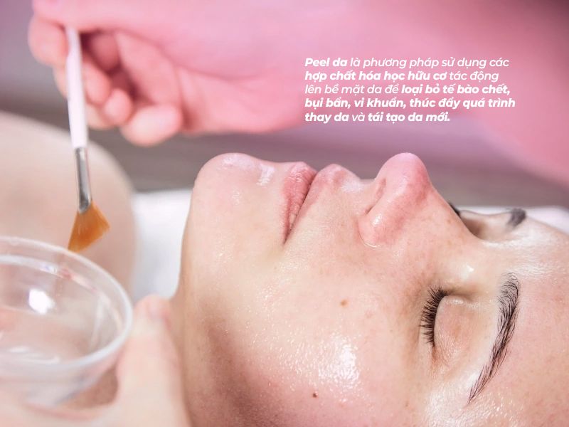 Peel da là gì, phương pháp peel da