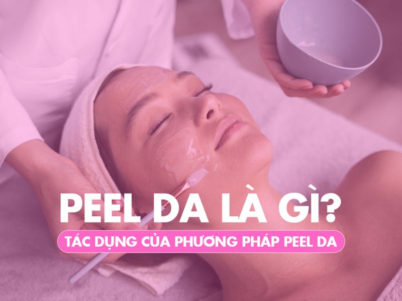 Peel da là gì