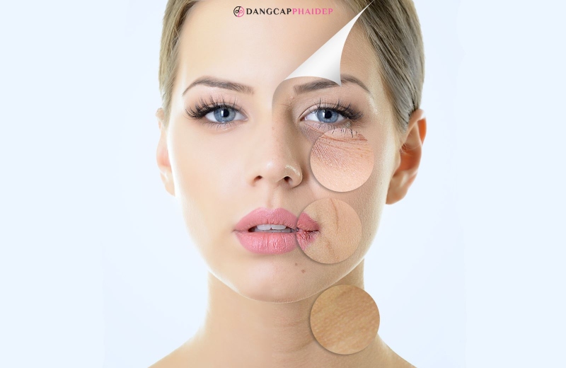 Làm sao để biết được cơ thể đang bị thiếu hụt collagen?