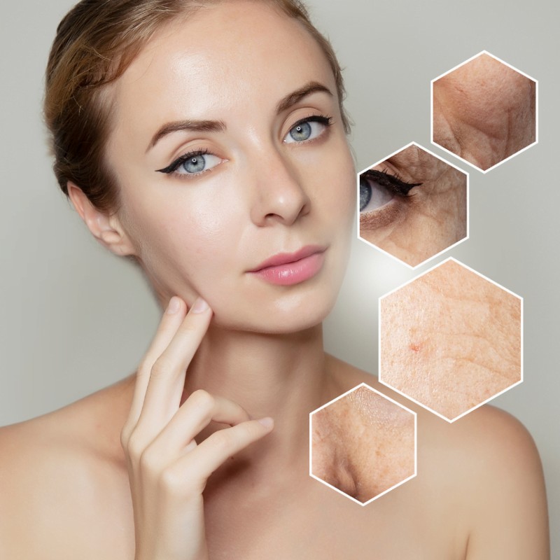 NMN cải thiện rõ rệt các dấu hiệu lão hóa trên da.