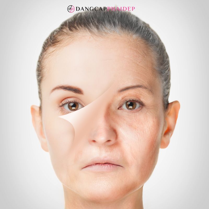 Viên uống chống nắng còn ngăn ngừa các tình trạng lão hóa da.
